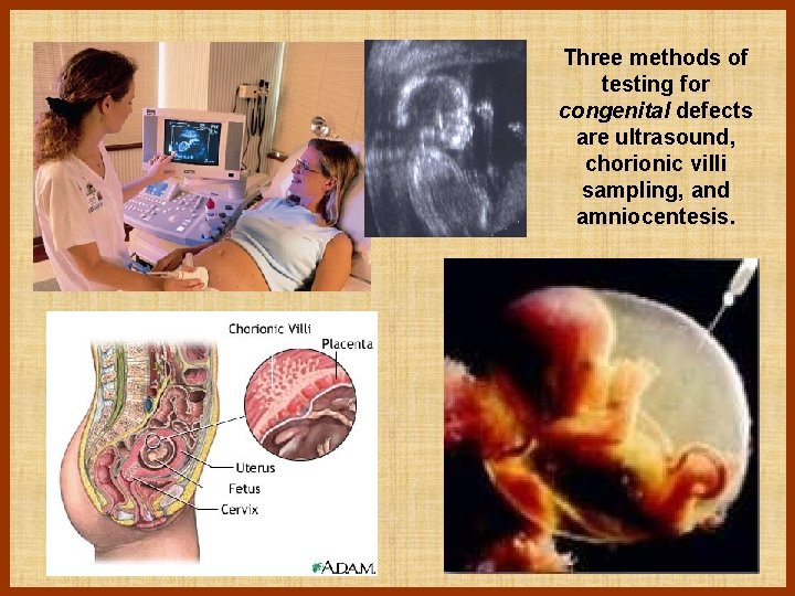 Three methods of testing for congenital defects are ultrasound, chorionic villi sampling, and amniocentesis.