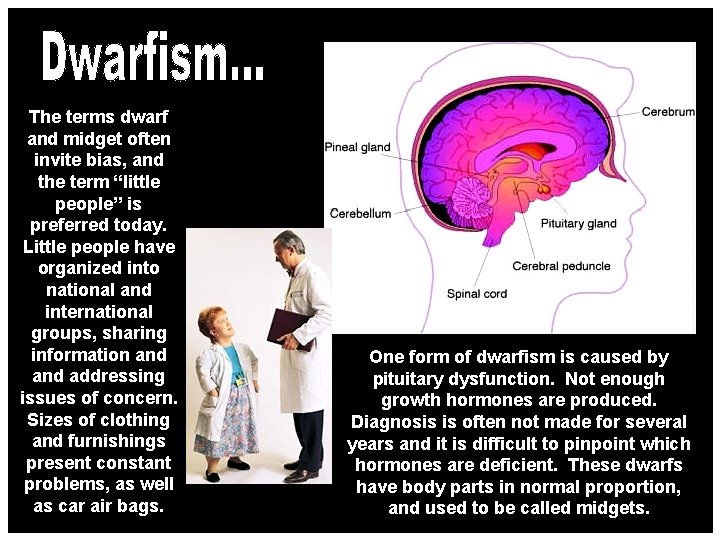 The terms dwarf and midget often invite bias, and the term “little people” is