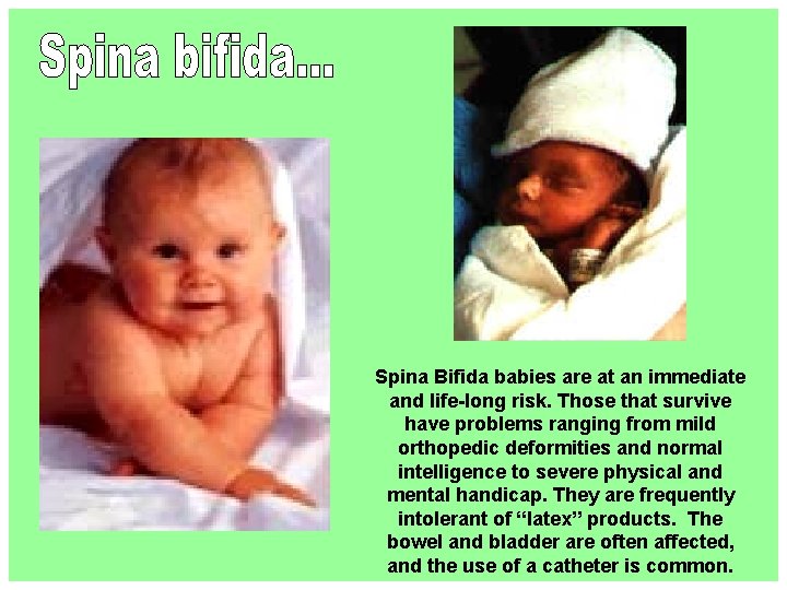 Spina Bifida babies are at an immediate and life-long risk. Those that survive have