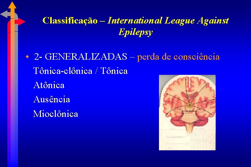 Classificação – International League Against Epilepsy • 2 - GENERALIZADAS – perda de consciência