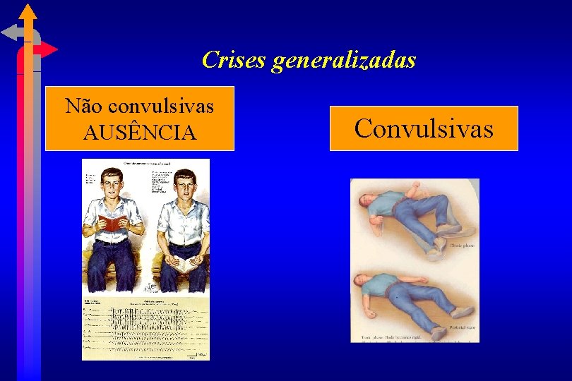 Crises generalizadas Não convulsivas AUSÊNCIA Convulsivas 