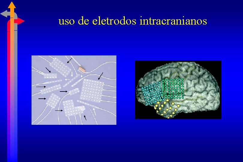  uso de eletrodos intracranianos 