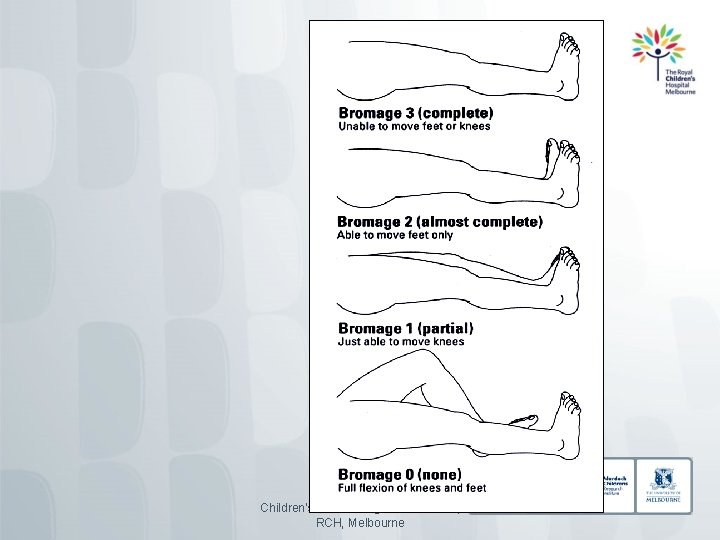 Children's Pain Management Service, RCH, Melbourne 