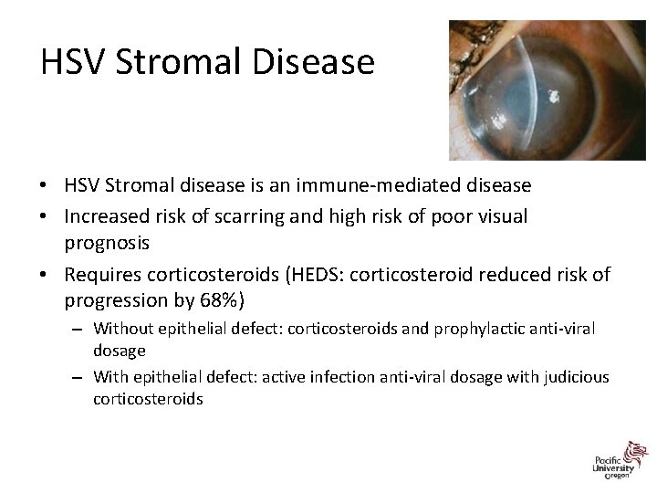 HSV Stromal Disease • HSV Stromal disease is an immune-mediated disease • Increased risk