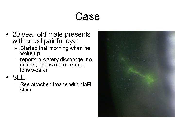 Case • 20 year old male presents with a red painful eye – Started