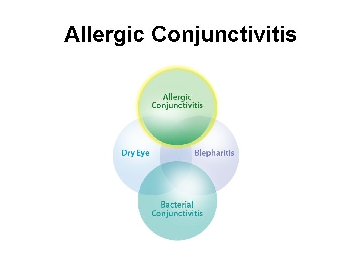 Allergic Conjunctivitis 