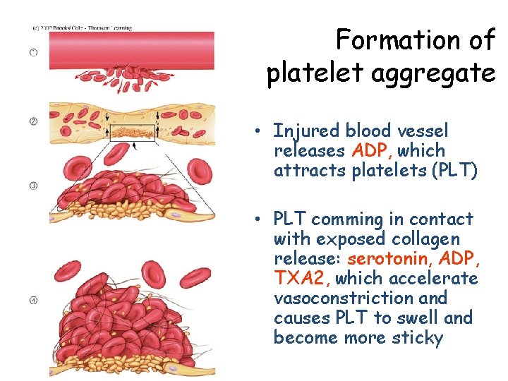Formation of platelet aggregate • Injured blood vessel releases ADP, which attracts platelets (PLT)