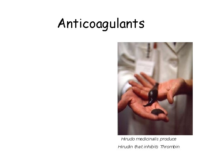 Anticoagulants Hirudo medicinalis produce Hirudin that inhibits Thrombin 