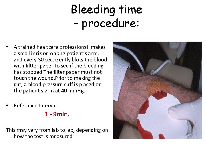 Bleeding time – procedure: • A trained healtcare professionall makes a small incision on