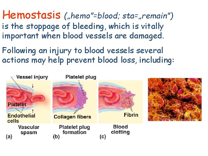 Hemostasis („hemo”=blood; sta=„remain”) is the stoppage of bleeding, which is vitally important when blood