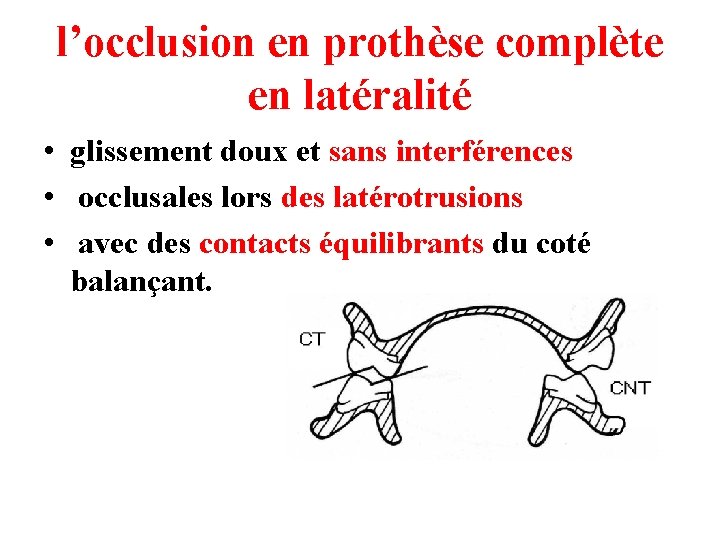 l’occlusion en prothèse complète en latéralité • glissement doux et sans interférences • occlusales