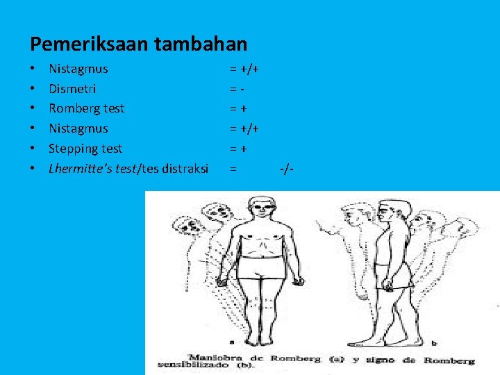 Pemeriksaan tambahan • • • Nistagmus Dismetri Romberg test Nistagmus Stepping test Lhermitte’s test/tes