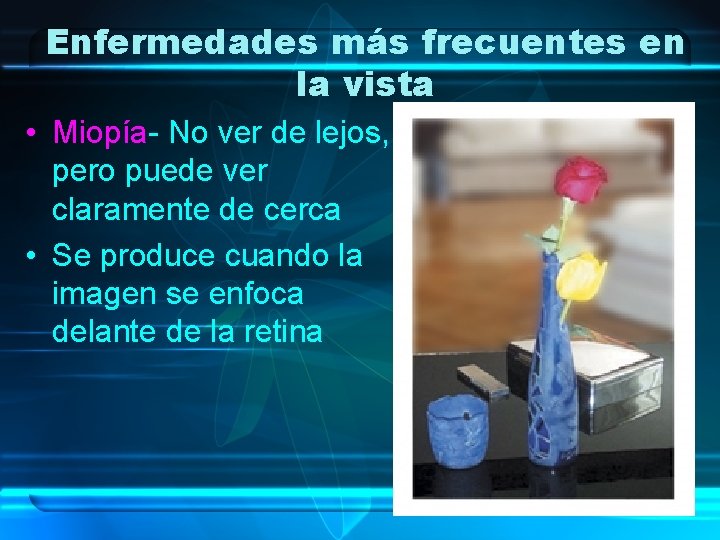 Enfermedades más frecuentes en la vista • Miopía- No ver de lejos, pero puede