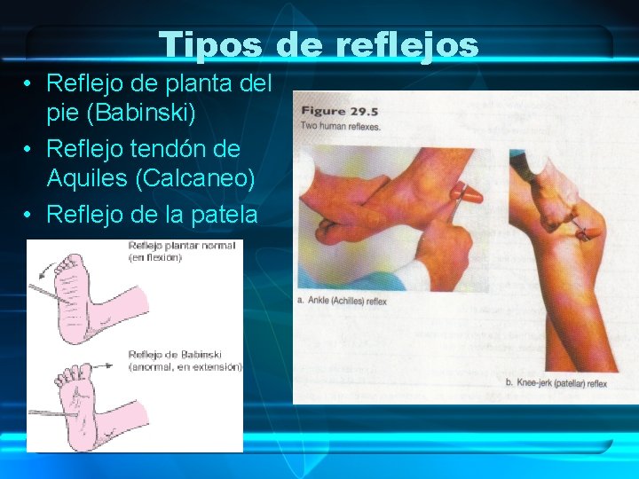Tipos de reflejos • Reflejo de planta del pie (Babinski) • Reflejo tendón de