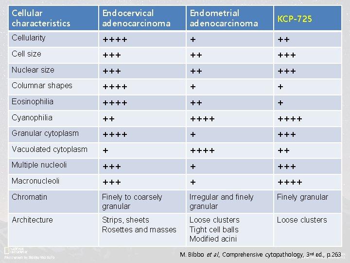 Cellular characteristics Endocervical adenocarcinoma Endometrial adenocarcinoma KCP-725 Cellularity ++++ + ++ Cell size +++