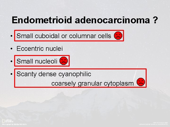 Endometrioid adenocarcinoma ? • Small cuboidal or columnar cells • Eccentric nuclei • Small