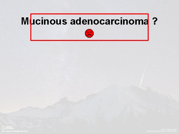 Mucinous adenocarcinoma ? 