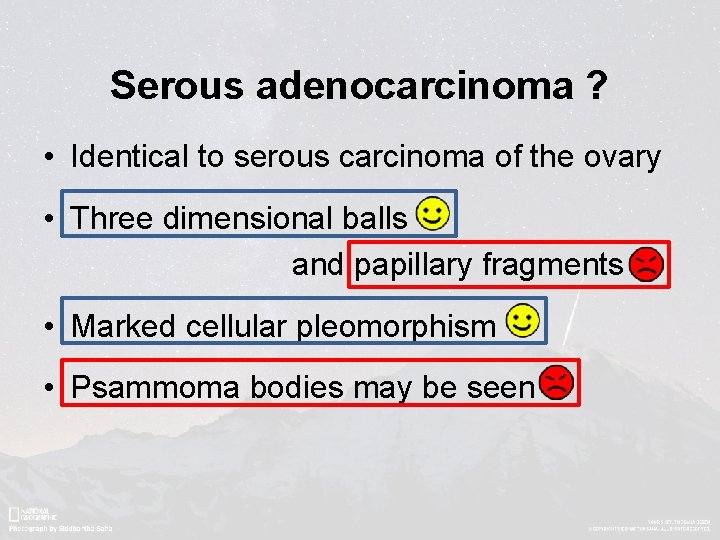 Serous adenocarcinoma ? • Identical to serous carcinoma of the ovary • Three dimensional