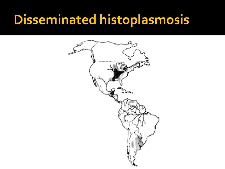 Disseminated histoplasmosis 
