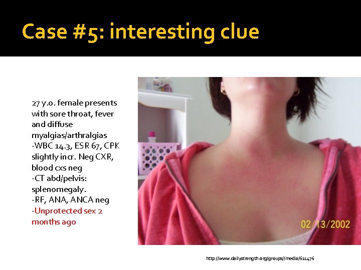 Case #5: interesting clue 27 y. o. female presents with sore throat, fever and
