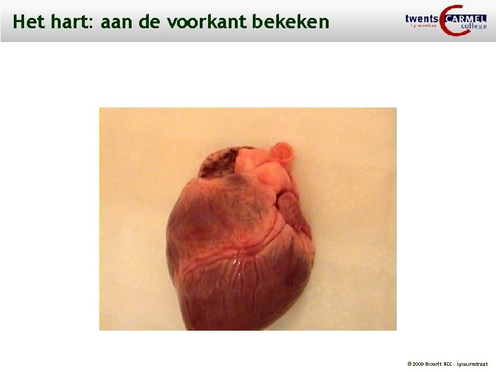 Het hart: aan de voorkant bekeken © 2009 Biosoft TCC - Lyceumstraat 