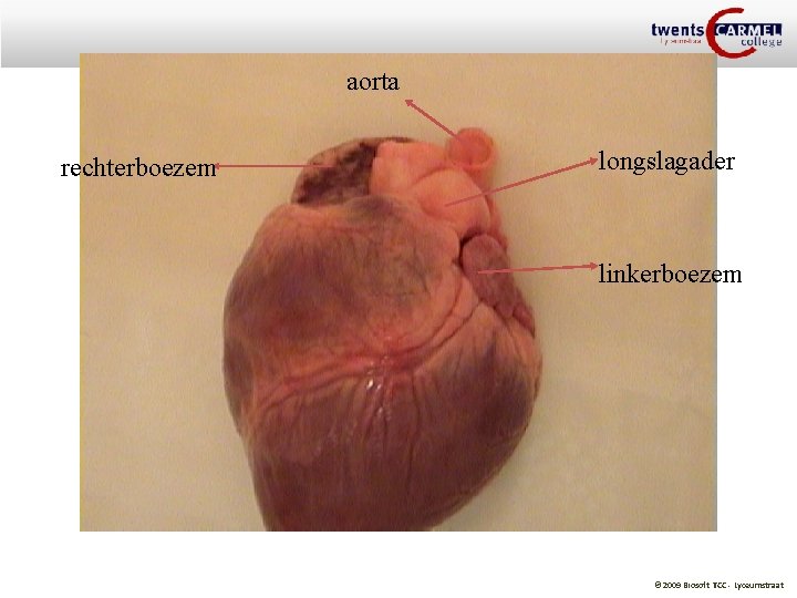 aorta rechterboezem longslagader linkerboezem © 2009 Biosoft TCC - Lyceumstraat 