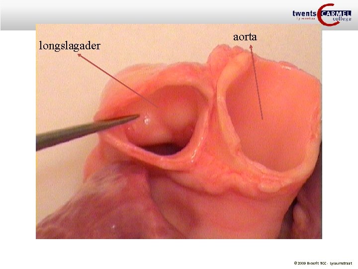 longslagader aorta © 2009 Biosoft TCC - Lyceumstraat 