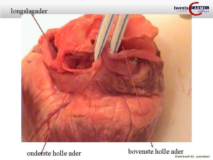 longslagader onderste holle ader bovenste holle ader © 2009 Biosoft TCC - Lyceumstraat 