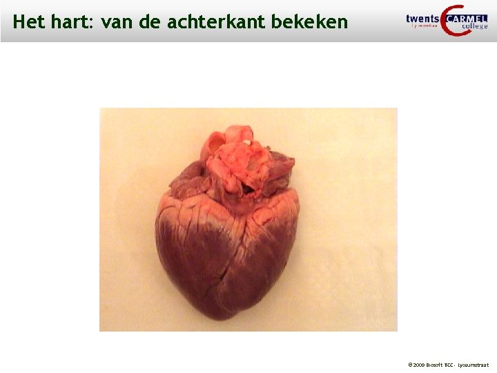 Het hart: van de achterkant bekeken © 2009 Biosoft TCC - Lyceumstraat 
