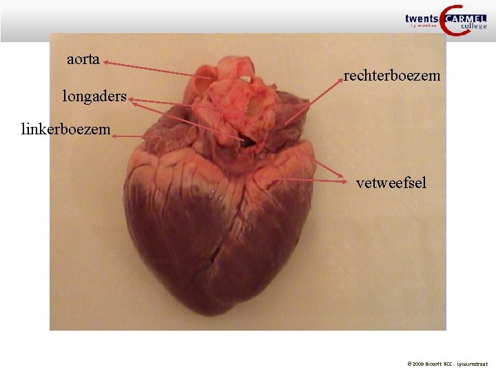 aorta rechterboezem longaders linkerboezem vetweefsel © 2009 Biosoft TCC - Lyceumstraat 