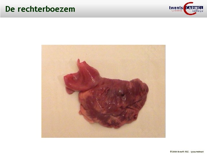 De rechterboezem © 2009 Biosoft TCC - Lyceumstraat 