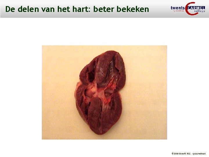 De delen van het hart: beter bekeken © 2009 Biosoft TCC - Lyceumstraat 