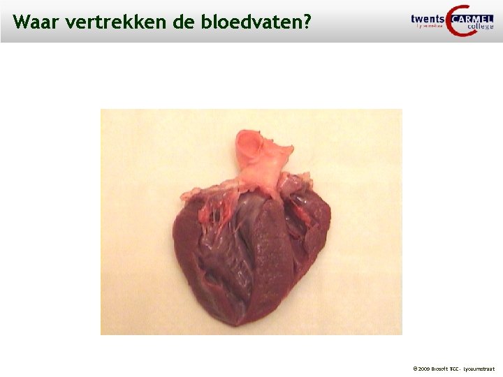 Waar vertrekken de bloedvaten? © 2009 Biosoft TCC - Lyceumstraat 