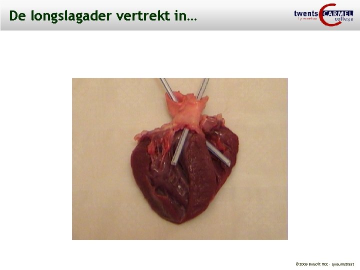De longslagader vertrekt in… © 2009 Biosoft TCC - Lyceumstraat 