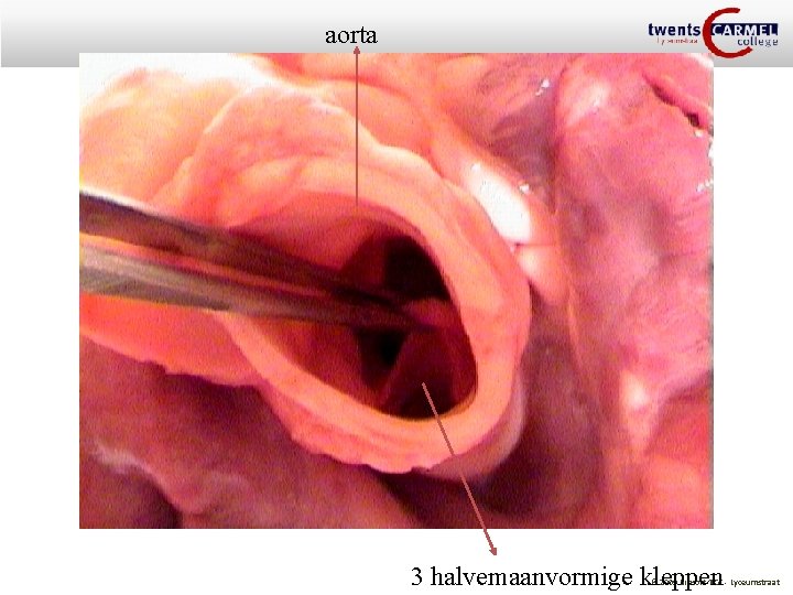 aorta 3 halvemaanvormige kleppen © 2009 Biosoft TCC - Lyceumstraat 