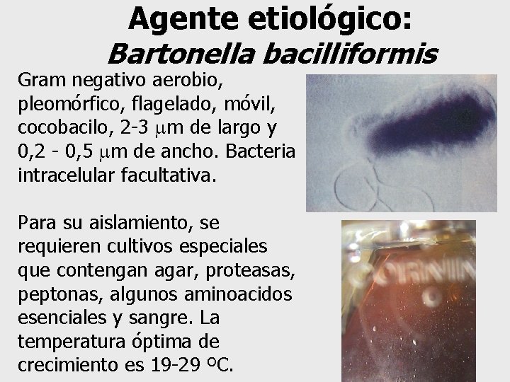 Agente etiológico: Bartonella bacilliformis Gram negativo aerobio, pleomórfico, flagelado, móvil, cocobacilo, 2 -3 m