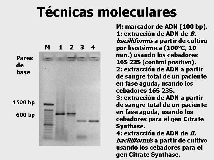 Técnicas moleculares M Pares de base 1500 bp 600 bp 1 2 3 4
