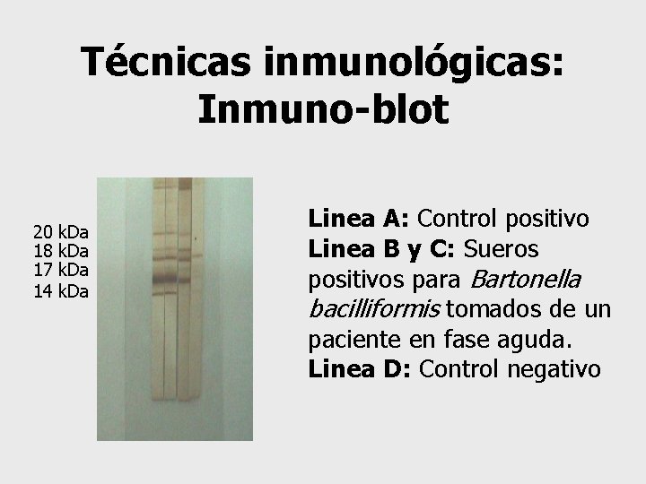 Técnicas inmunológicas: Inmuno-blot 20 18 17 14 Linea A: Control positivo Linea B y