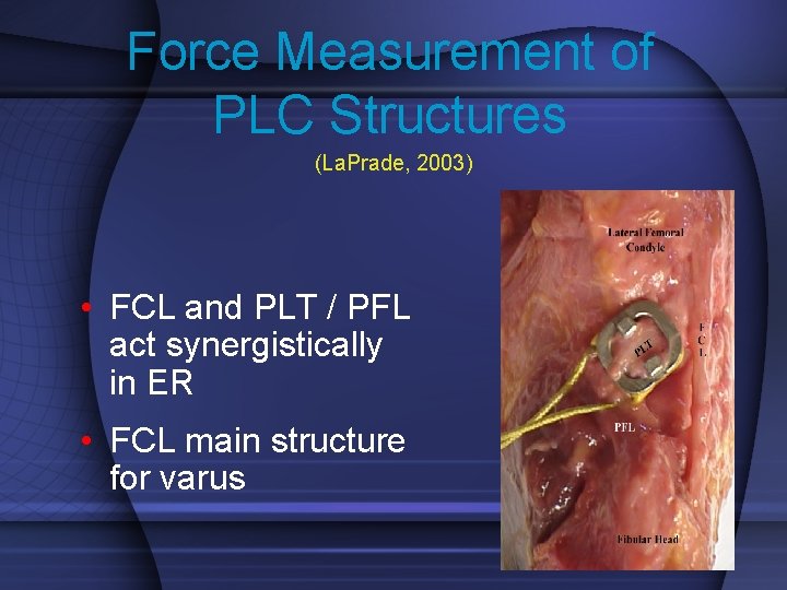 Force Measurement of PLC Structures (La. Prade, 2003) • FCL and PLT / PFL