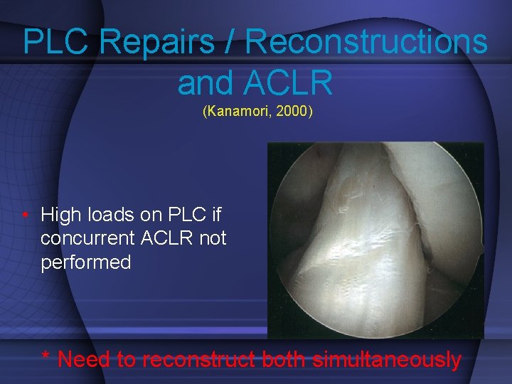 PLC Repairs / Reconstructions and ACLR (Kanamori, 2000) • High loads on PLC if