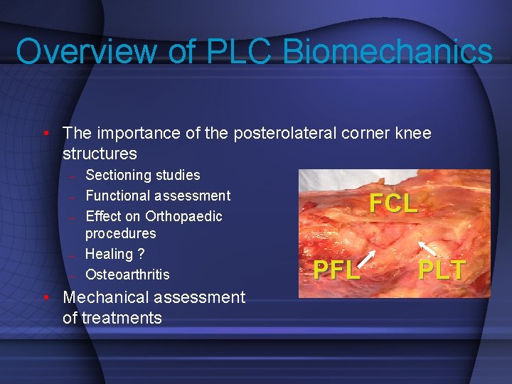 Overview of PLC Biomechanics • The importance of the posterolateral corner knee structures –