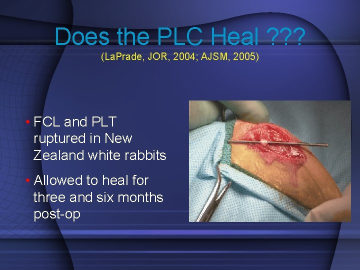 Does the PLC Heal ? ? ? (La. Prade, JOR, 2004; AJSM, 2005) •