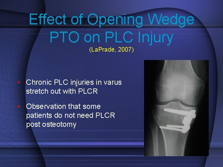 Effect of Opening Wedge PTO on PLC Injury (La. Prade, 2007) • Chronic PLC