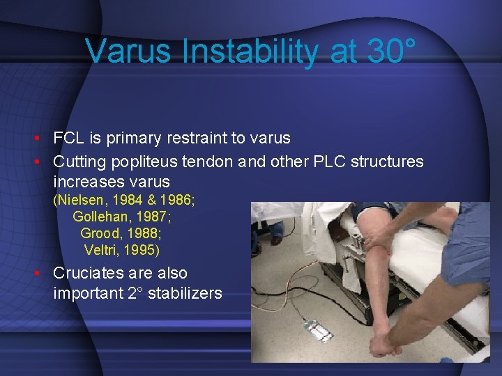 Varus Instability at 30° • FCL is primary restraint to varus • Cutting popliteus
