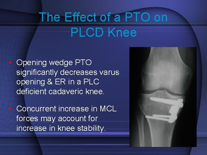 The Effect of a PTO on PLCD Knee • Opening wedge PTO significantly decreases