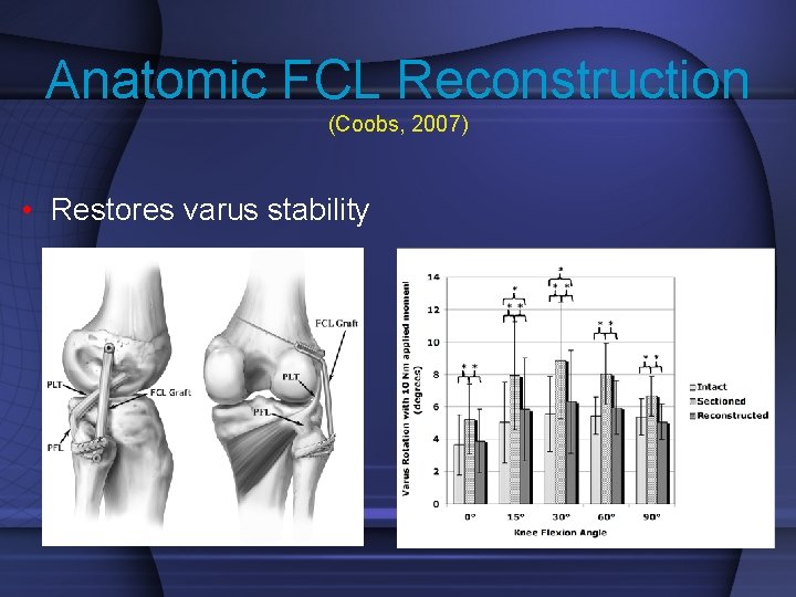 Anatomic FCL Reconstruction (Coobs, 2007) • Restores varus stability 