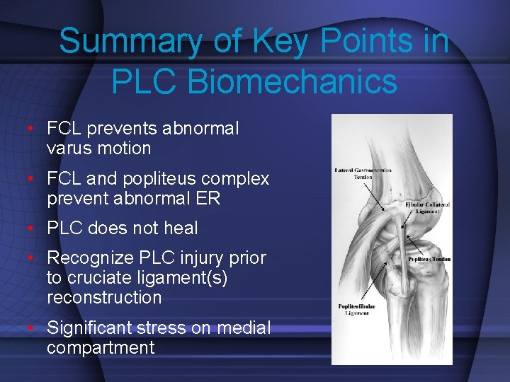 Summary of Key Points in PLC Biomechanics • FCL prevents abnormal varus motion •