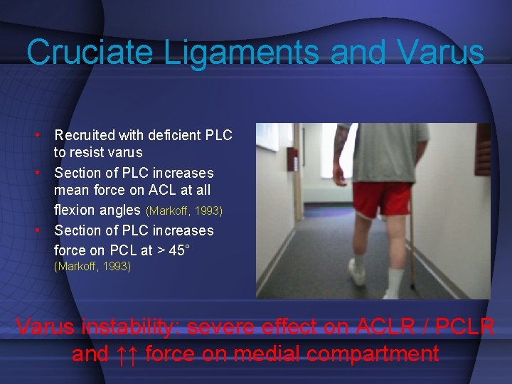 Cruciate Ligaments and Varus • Recruited with deficient PLC to resist varus • Section