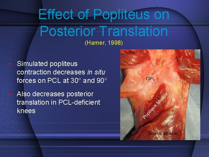 Effect of Popliteus on Posterior Translation (Harner, 1998) • Simulated popliteus contraction decreases in