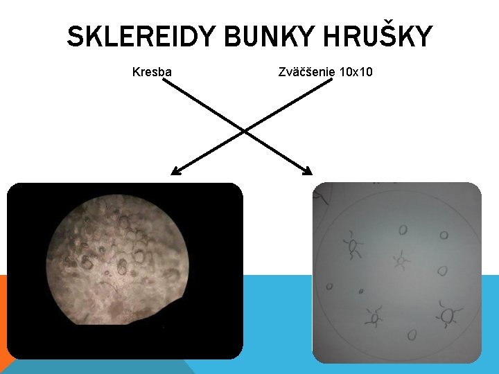 SKLEREIDY BUNKY HRUŠKY Kresba Zväčšenie 10 x 10 